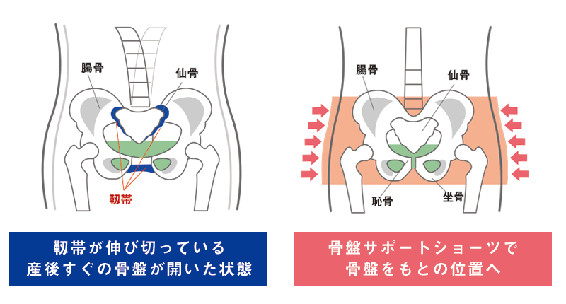 ショーツで骨盤をもとの位置へ
