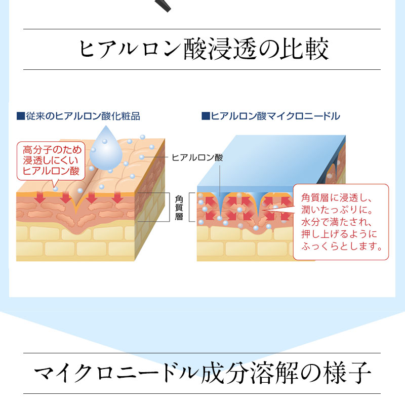 モイスチャーマイクロパッチ